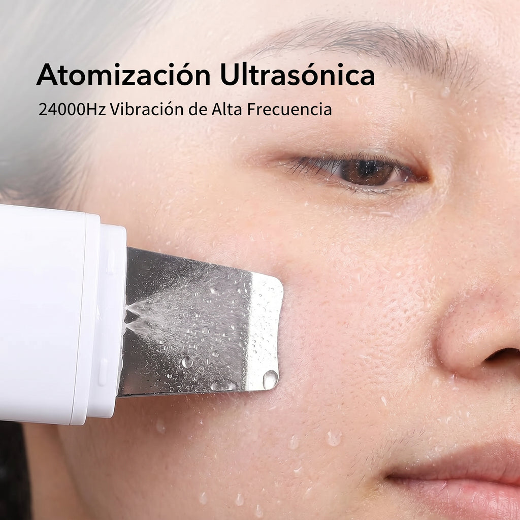 Removedor Ultrasónico de Puntos Negros – Limpieza Facial Profunda