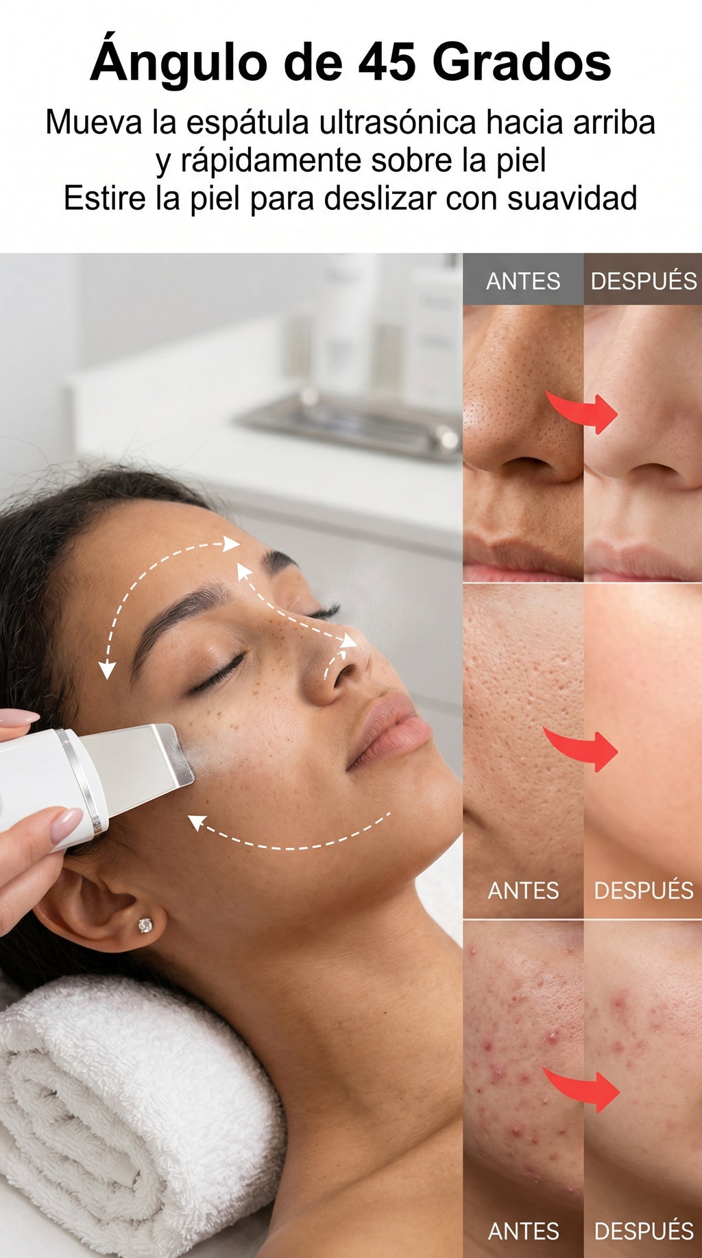 Removedor Ultrasónico de Puntos Negros – Limpieza Facial Profunda