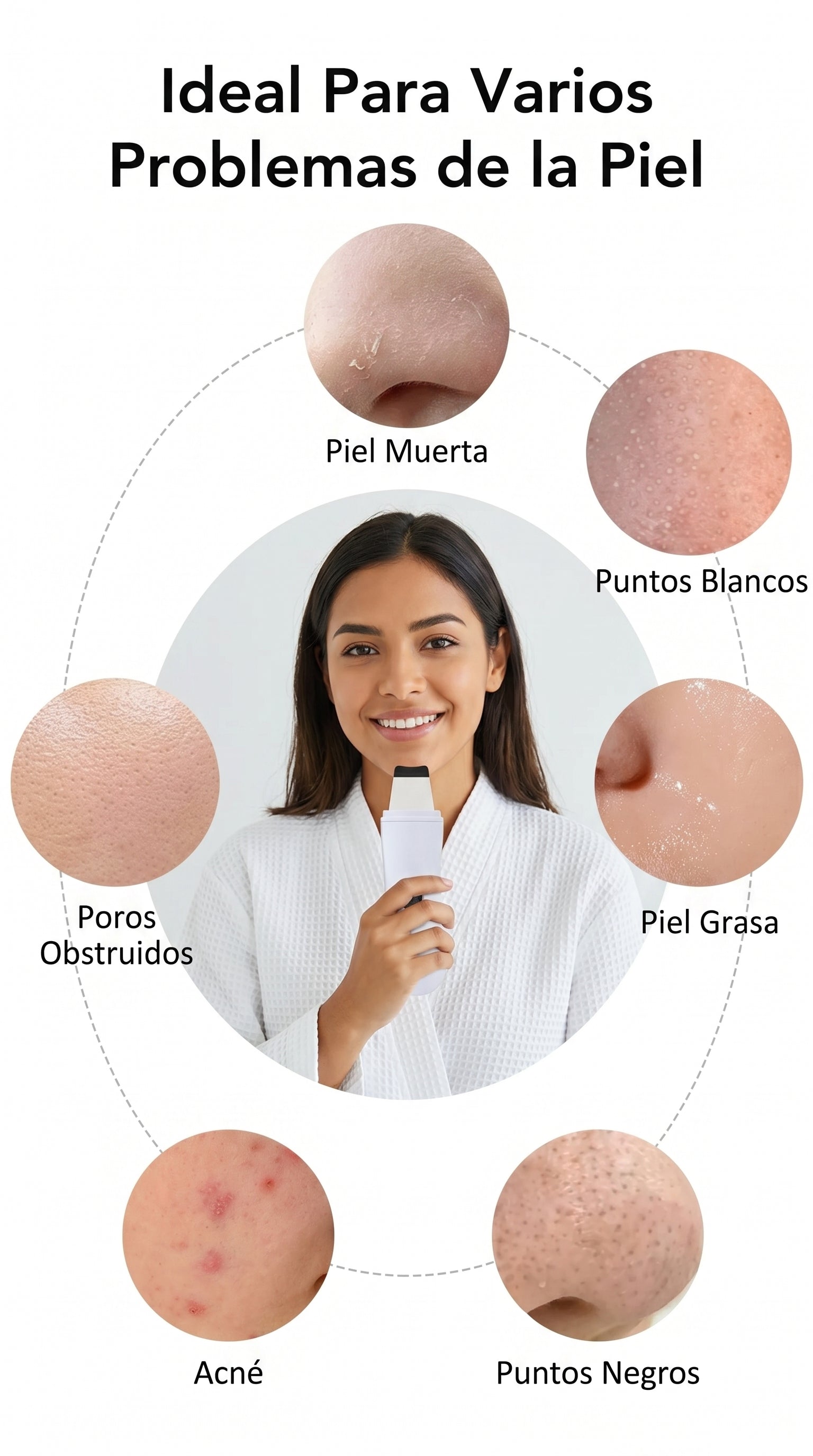 Removedor Ultrasónico de Puntos Negros – Limpieza Facial Profunda